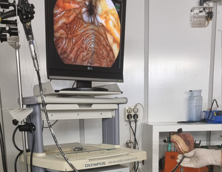 Diagnóstico de endoscopio